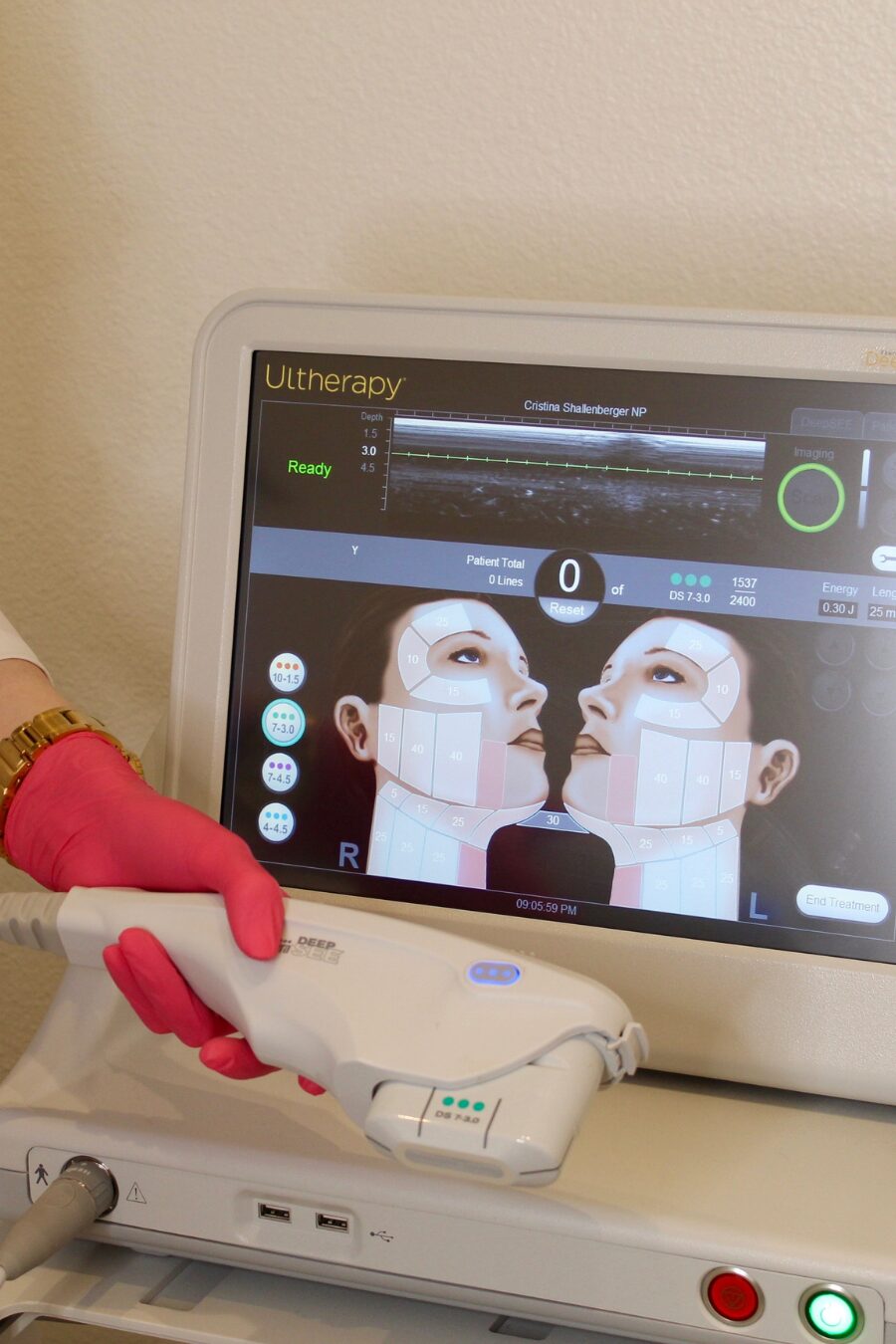 ULTherapy